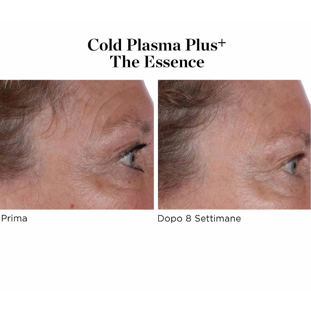 QVC Perricone MD Siero viso Cold Plasma Plus+ The Essence Duty-free
