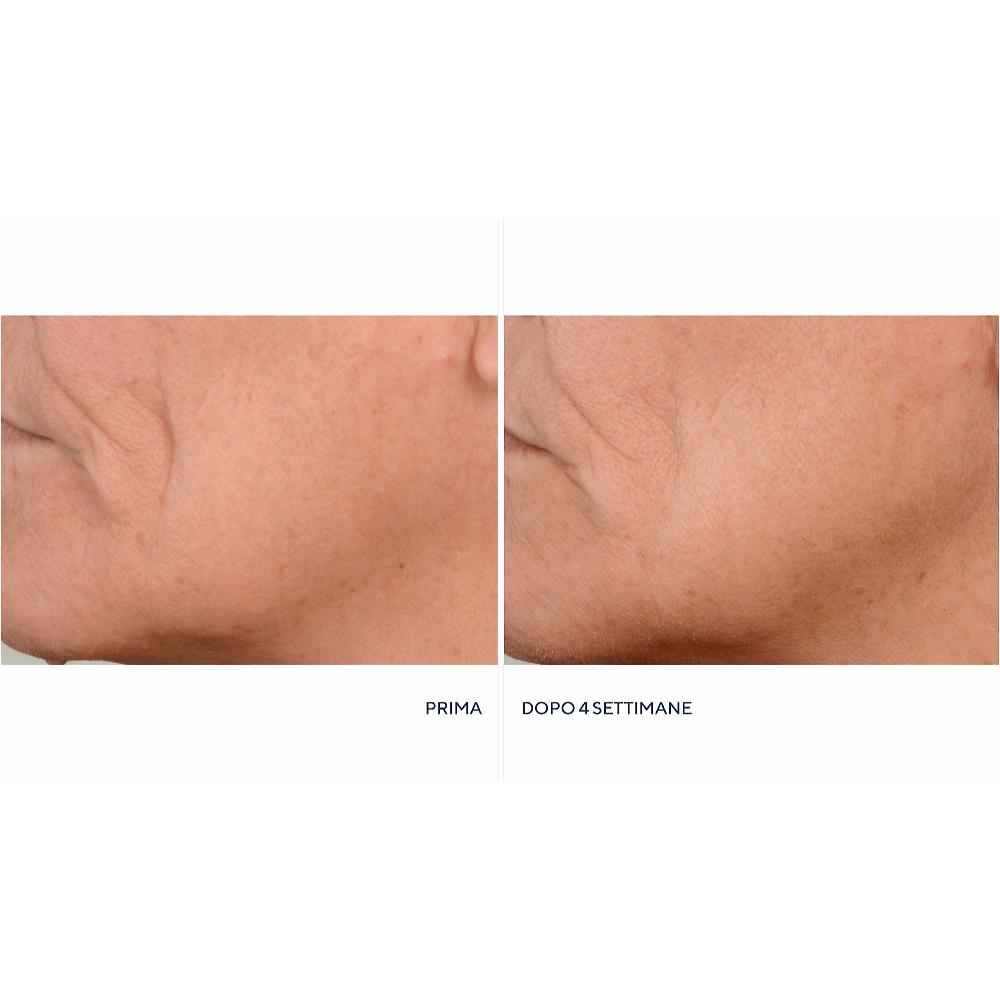 QVC Perricone MD Crema notte Essential FX + siero Firming&Lifting Limitato a 3 giorni