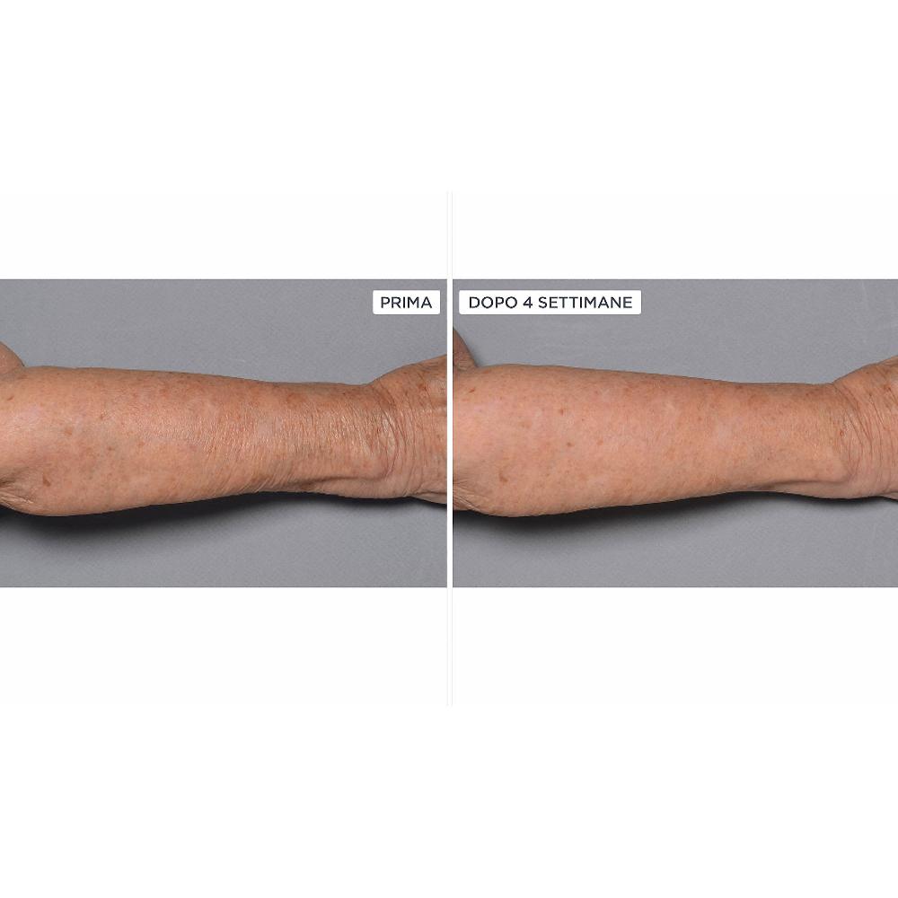 QVC Perricone MD Cold Plasma+Fragile Skin corpo 2pz Sostegno trimestrale