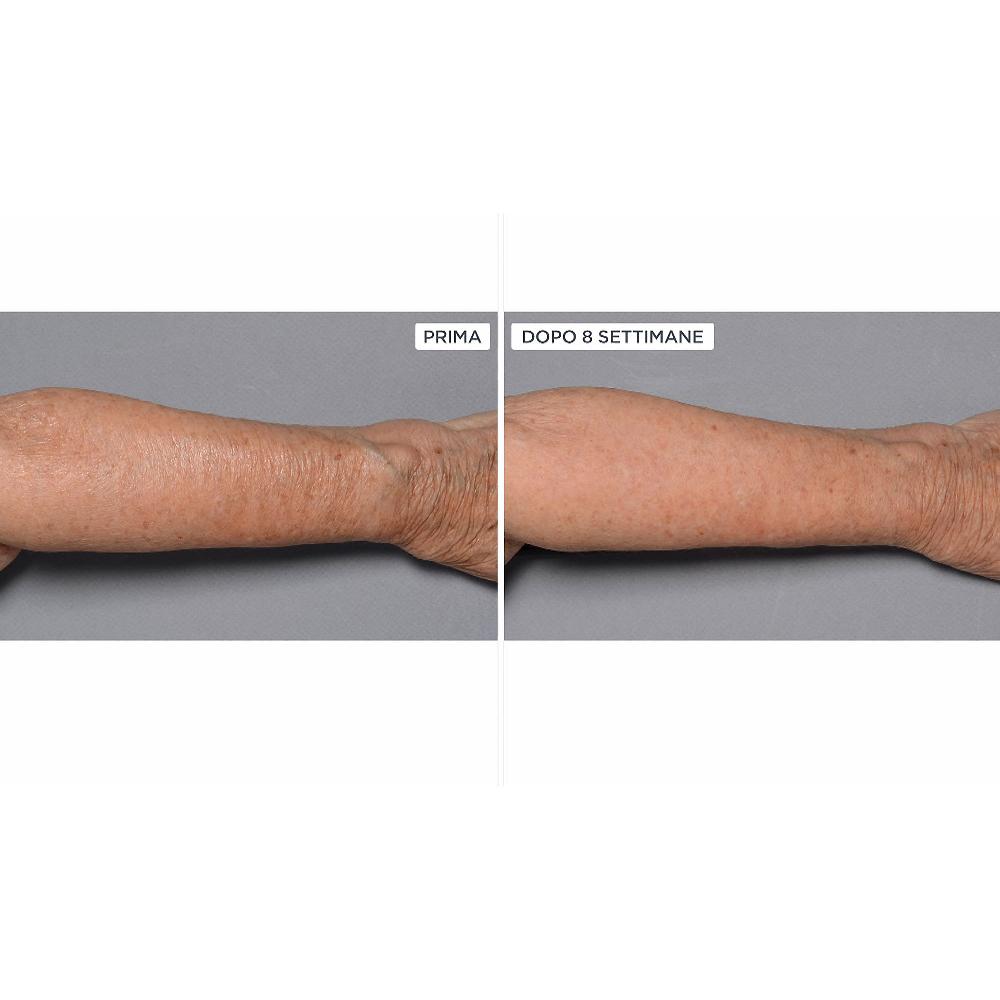 QVC Perricone MD Cold Plasma+Fragile Skin corpo 2pz Sostegno trimestrale