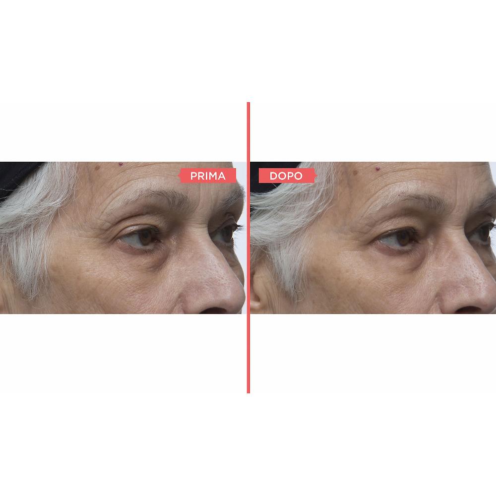 QVC Perricone MD Eyelid Serum Duo siero occhi antiossidante Spedizione gratuita