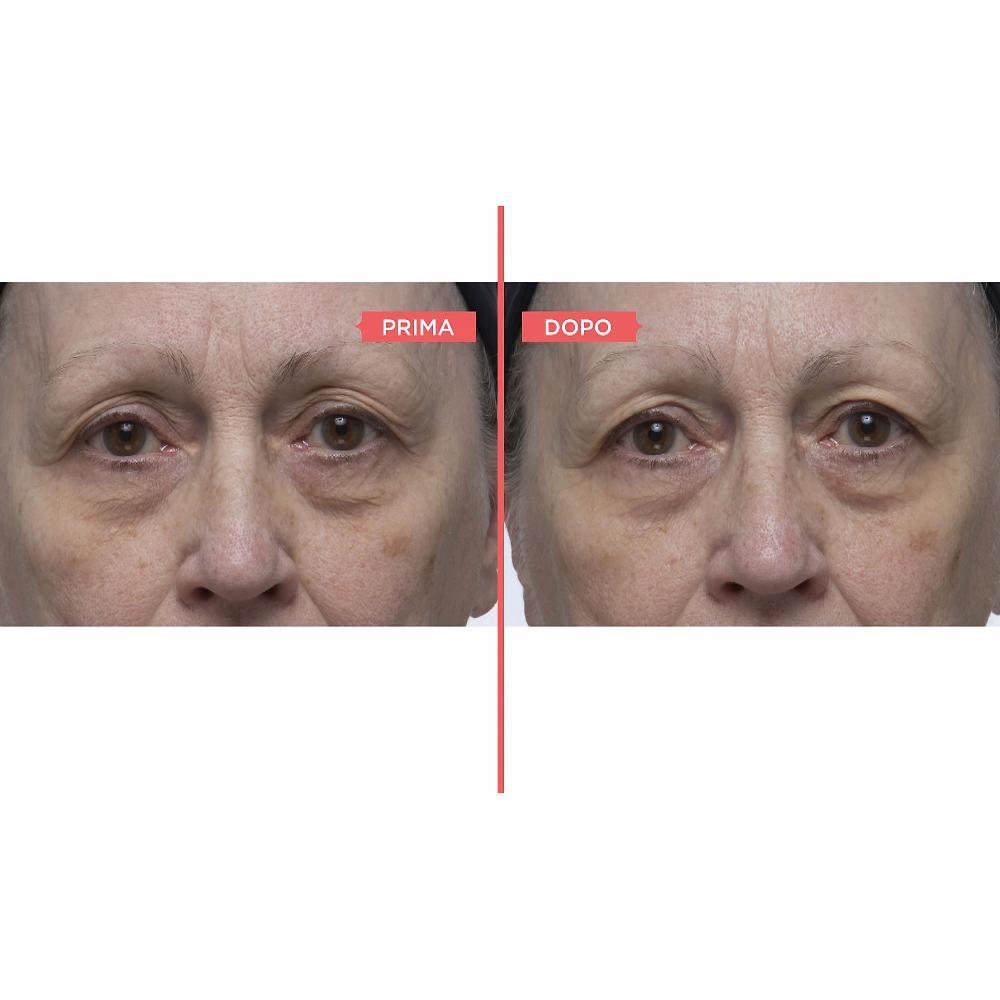 QVC Perricone MD Eyelid Serum Duo siero occhi antiossidante Spedizione gratuita