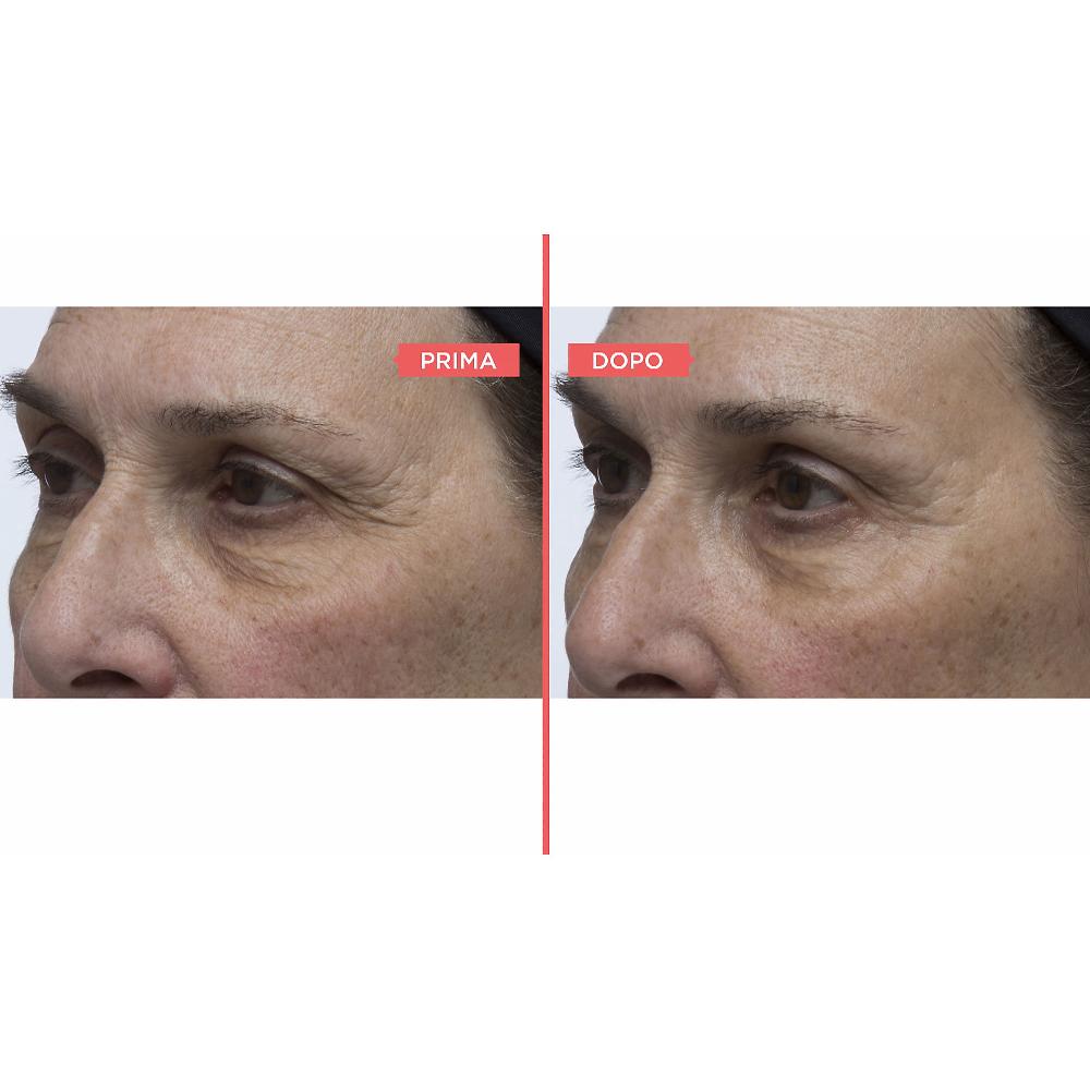 QVC Perricone MD Eyelid Serum Duo siero occhi antiossidante Spedizione gratuita